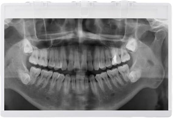 X-Ray Film Illuminator Light Box X-ray Viewer LED Light Panel 10W AC100-240V Panorama Film Viewer