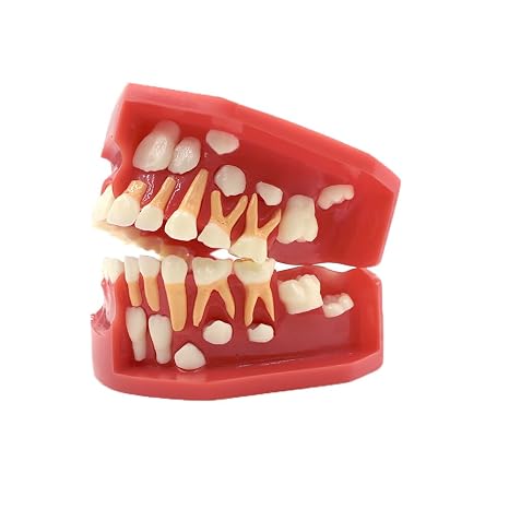 Dental Pediatrics Teeth Model Children Primary Permanent Alternate 3-12 Years Old (6-9 Years Old)