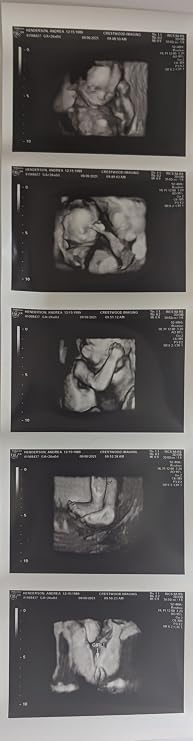 Prank 3D Customized Fake Ultrasound Strip of 5 Photos